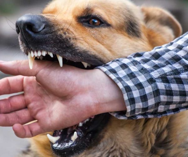 How Soon Should I File Claims After a Dog Bite Injury?