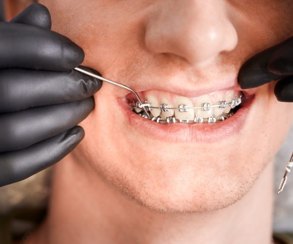 What Kind of Problems Can Be Treated with Orthodontics?